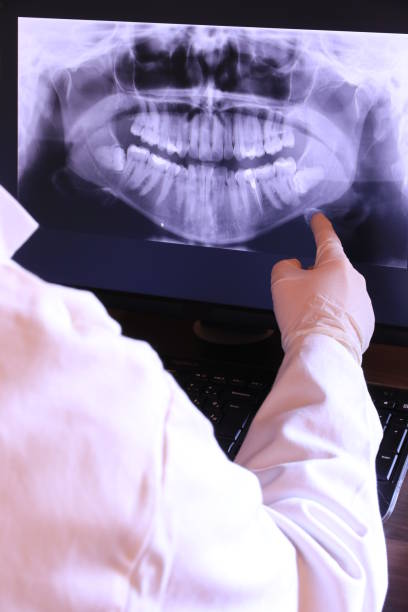 Best Emergency Dental Extractions in Earlington, KY