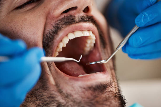 Best Emergency Dentist for Lost Fillings or Crowns in Earlington, KY